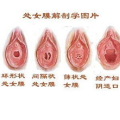 女性私密膜,女性生殖健康的守护者